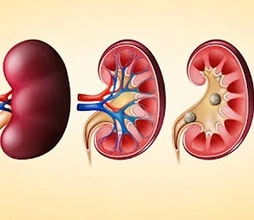 Best Urologist in Rewari