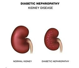 Best Nephrologist in Haryana